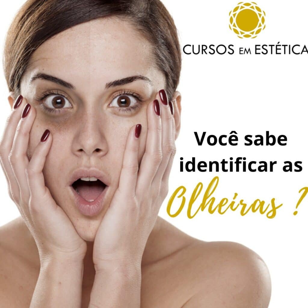 identificar-olheiras